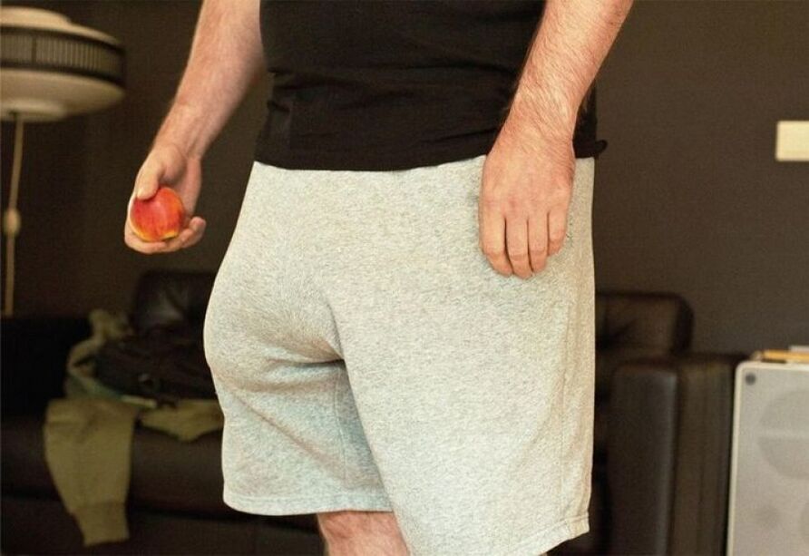 A man with an enlarged member